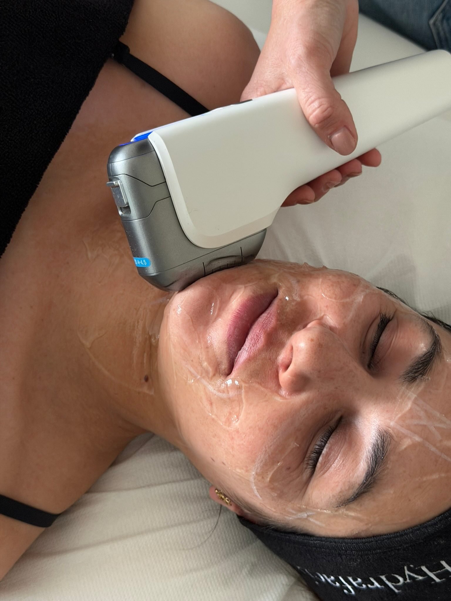 Soin visage HIFU réalisé chez Jude Aesthetic